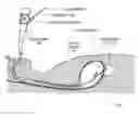 Fig. 01 - MULTI-LUMEN ENDOSCOPIC METHOD, ACCESSORY, AND SYSTEM