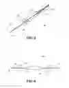 Fig. 04 - MULTI-LUMEN ENDOSCOPIC METHOD, ACCESSORY, AND SYSTEM