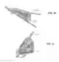Fig. 09 - Surgical tissue protection sheath