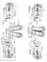 Fig. 10 - Surgical tissue protection sheath