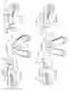 Fig. 12 - Surgical tissue protection sheath