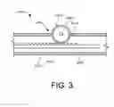 Fig. 04 - Adjustable medical devices and methods for manipulating bodily tissues