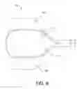 Fig. 07 - Adjustable medical devices and methods for manipulating bodily tissues