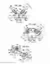 Fig. 17 - Crossbar spinal prosthesis having a modular design and related implantation methods