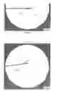 Fig. 05 - HAMMERTOE IMPLANT