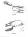 Fig. 07 - HAMMERTOE IMPLANT