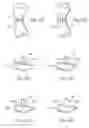 Fig. 07 - Devices, systems and methods for re-alignment of bone