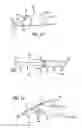Fig. 07 - System and method for facilitating repair and reattachment of comminuted bone portions