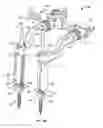 Fig. 04 - Tissue retraction and vertebral displacement devices, systems, and methods for posterior spinal fusion