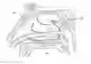 Fig. 01 - Apparatus and methods for treating rhinitis