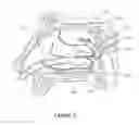 Fig. 15 - Apparatus and methods for treating rhinitis