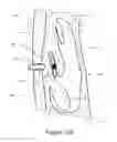 Fig. 22 - Apparatus and methods for treating rhinitis