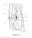 Fig. 23 - Apparatus and methods for treating rhinitis