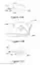 Fig. 31 - Apparatus and methods for treating rhinitis