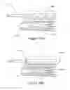 Fig. 41 - Apparatus and methods for treating rhinitis
