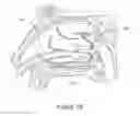 Fig. 43 - Apparatus and methods for treating rhinitis