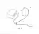 Fig. 02 - Endovascular plasma treatment device and method of use