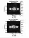 Fig. 22 - Electroporation with cooling to treat tissue