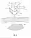 Fig. 15 - Microwave spacers and method of use