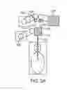 Fig. 08 - Endoscopic device with helical lumen design