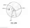 Fig. 55 - Endoscopic device with double-helical lumen design