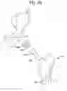Fig. 04 - Surgical system for positioning prosthetic component and/or for constraining movement of surgical tool