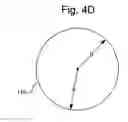 Fig. 10 - Surgical system for positioning prosthetic component and/or for constraining movement of surgical tool