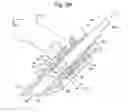 Fig. 12 - Surgical system for positioning prosthetic component and/or for constraining movement of surgical tool