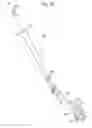 Fig. 17 - Surgical system for positioning prosthetic component and/or for constraining movement of surgical tool