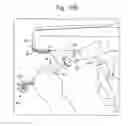 Fig. 25 - Surgical system for positioning prosthetic component and/or for constraining movement of surgical tool