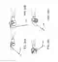 Fig. 16 - INTERFACE BETWEEN USER AND LAPAROSCOPIC TOOLS