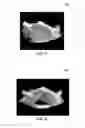 Fig. 07 - METHODS AND SYSTEMS FOR INTERVENTIONAL IMAGING