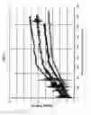 Fig. 06 - Medical instrument with modified memory and flexibility properties and method