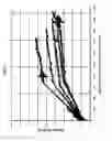Fig. 07 - Medical instrument with modified memory and flexibility properties and method