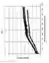 Fig. 08 - Medical instrument with modified memory and flexibility properties and method