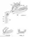 Fig. 06 - Laser orthodontic devices