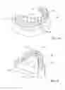 Fig. 02 - DENTAL BRIDGE SYSTEM AND METHOD