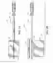 Fig. 02 - Endoscopic system for winding and inserting a mesh