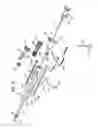 Fig. 07 - Vessel harvester