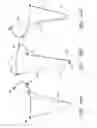 Fig. 28 - Device, system, and method for transcatheter treatment of valve regurgitation