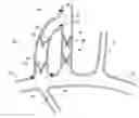 Fig. 01 - Methods and apparatus for treating neurovascular venous outflow obstruction