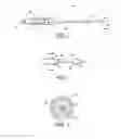 Fig. 03 - Methods and apparatus for treating neurovascular venous outflow obstruction
