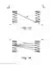 Fig. 06 - Methods and apparatus for treating neurovascular venous outflow obstruction