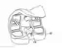 Fig. 01 - Methods and devices for knee joint replacement with anterior cruciate ligament substitution