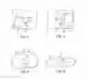 Fig. 05 - Methods and devices for knee joint replacement with anterior cruciate ligament substitution