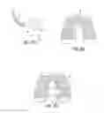 Fig. 07 - Methods and devices for knee joint replacement with anterior cruciate ligament substitution