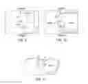 Fig. 08 - Methods and devices for knee joint replacement with anterior cruciate ligament substitution