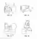 Fig. 11 - Methods and devices for knee joint replacement with anterior cruciate ligament substitution