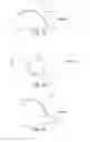 Fig. 16 - Methods and devices for knee joint replacement with anterior cruciate ligament substitution