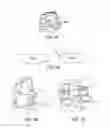 Fig. 23 - Methods and devices for knee joint replacement with anterior cruciate ligament substitution